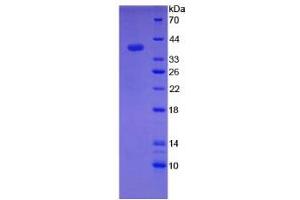 SDS-PAGE analysis of Rat Hepcidin Protein. (Hepcidin Protein)