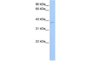 RPL3 antibody used at 1 ug/ml to detect target protein. (RPL3 Antikörper  (C-Term))
