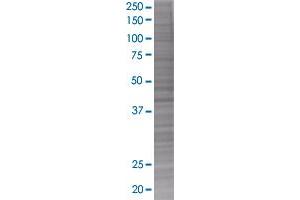 TNNT2 transfected lysate. (TNNT2 293T Cell Transient Overexpression Lysate(Denatured))