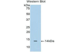 Western Blotting (WB) image for anti-Cyclin-Dependent Kinase 2 (CDK2) (AA 94-198) antibody (ABIN1175171) (CDK2 Antikörper  (AA 94-198))