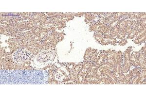 Immunohistochemistry of paraffin-embedded Rat kidney tissue using CD10 Monoclonal Antibody at dilution of 1:200. (MME Antikörper)
