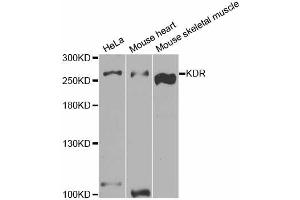 Western blot analysis of extracts of various cell lines, using KDR antibody (ABIN5973267) at 1/1000 dilution. (VEGFR2/CD309 Antikörper)
