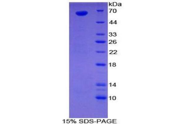 SULF1 Protein