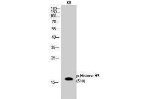 Western Blotting (WB) image for anti-Histone 3 (H3) (pSer10) antibody (ABIN3182028) (Histone 3 Antikörper  (pSer10))