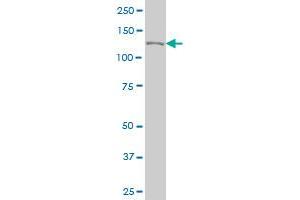 CAND1 monoclonal antibody (M03), clone 2D7 Western Blot analysis of CAND1 expression in Hela S3 NE . (CAND1 Antikörper  (AA 1-100))