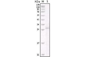 Western Blotting (WB) image for anti-Receptor tyrosine-protein kinase erbB-2 (ErbB2/Her2) antibody (ABIN2843749) (ErbB2/Her2 Antikörper)
