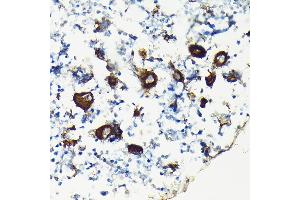 Immunohistochemistry of paraffin-embedded rat bone marrow using Integrin beta 3 (ITGB3/CD61) Rabbit pAb (ABIN6127572, ABIN6142584, ABIN6142586 and ABIN6219636) at dilution of 1:100 (40x lens). (Integrin beta 3 Antikörper  (AA 610-718))