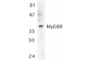 Image no. 1 for anti-Myeloid Differentiation Primary Response Gene (88) (MYD88) (AA 279-296), (C-Term) antibody (ABIN205874) (MYD88 Antikörper  (C-Term))