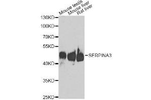 Western blot analysis of extracts of various cell lines, using SERPINA3 antibody. (SERPINA3 Antikörper  (AA 24-423))