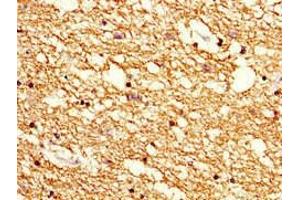 Immunohistochemistry of paraffin-embedded human brain tissue using ABIN7142178 at dilution of 1:100 (Cnpase Antikörper  (AA 226-415))