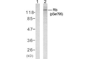 Western blot analysis of extracts from K562 cells untreated or treated with 10% serum after 48 hours of starvation, using Rb (phospho-Ser795) antibody (E011130). (Retinoblastoma 1 Antikörper  (pSer795))