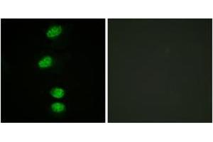 Immunofluorescence analysis of HeLa cells, using Androgen Receptor (Phospho-Ser94) Antibody. (Androgen Receptor Antikörper  (pSer94))
