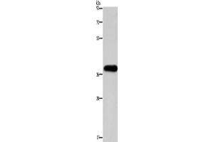 Western Blotting (WB) image for anti-Paired-Like Homeodomain 2 (PITX2) antibody (ABIN2422772) (PITX2 Antikörper)