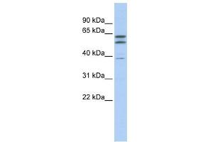 Beta Tubulin 2A antibody used at 1 ug/ml to detect target protein. (beta Tubulin 2A (N-Term) Antikörper)