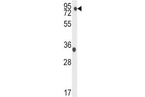 Western Blotting (WB) image for anti-TBK antibody (ABIN3003556) (TBK Antikörper)