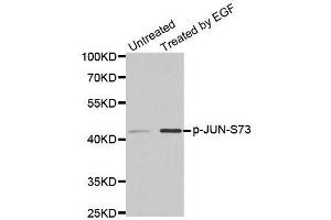 Western blot analysis of extracts from PC14 cells using phospho-JUN-S73 antibody (ABIN2987353). (C-JUN Antikörper  (pSer73))