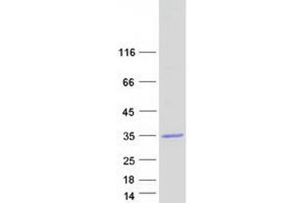 ABHD17B Protein (Transcript Variant 1) (Myc-DYKDDDDK Tag)