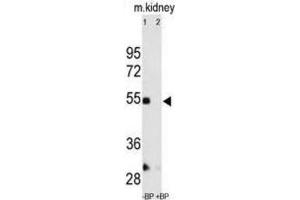 Western Blotting (WB) image for anti-Matrix Metallopeptidase 12 (Macrophage Elastase) (MMP12) antibody (ABIN2971009) (MMP12 Antikörper)