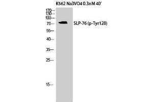 Western Blotting (WB) image for anti-Lymphocyte Cytosolic Protein 2 (SH2 Domain Containing Leukocyte Protein of 76kDa) (LCP2) (pTyr128) antibody (ABIN3179707) (LCP2 Antikörper  (pTyr128))