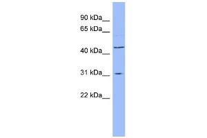 WB Suggested Anti-DHODH Antibody Titration:  0. (DHODH Antikörper  (N-Term))