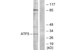 Western blot analysis of extracts from Jurkat cells, using ATF5 antibody. (ATF5 Antikörper  (C-Term))