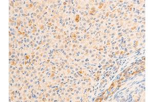 Immunohistochemistry (IHC) image for anti-Nuclear Factor-kB p65 (NFkBP65) (pSer536) antibody (ABIN6255402)