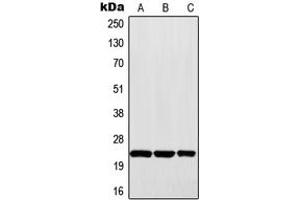 Western blot analysis of MAD2 expression in Raji (A), HepG2 (B), A431 (C) whole cell lysates. (MAD2 Antikörper  (Center))