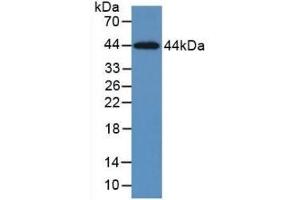 Detection of Recombinant KRT5, Human using Monoclonal Antibody to Cytokeratin 5 (CK5) (Cytokeratin 5 Antikörper  (AA 168-481))