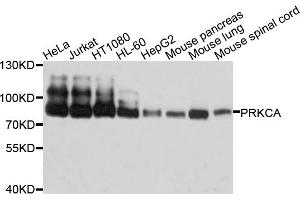 Western blot analysis of extracts of various cell lines, using PRKCA antibody. (PKC alpha Antikörper)