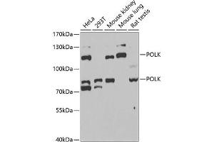 Western blot analysis of extracts of various cell lines, using POLK antibody (ABIN6128477, ABIN6145899, ABIN6145903 and ABIN6221718) at 1:1000 dilution. (POLK Antikörper  (AA 1-260))