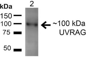 Western blot analysis of Rat Liver showing detection of ~100kDa UVRAG protein using Rabbit Anti-UVRAG Polyclonal Antibody . (UVRAG Antikörper  (Biotin))