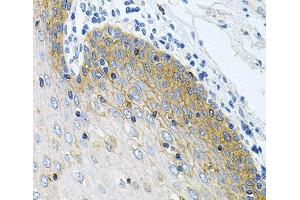 Immunohistochemistry of paraffin-embedded Human esophagus using GNE Polyclonal Antibody at dilution of 1:100 (40x lens). (GNE Antikörper)