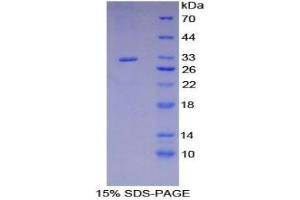 SDS-PAGE analysis of Mouse RYK Protein. (RYK Protein)