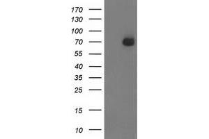 HEK293T cells were transfected with the pCMV6-ENTRY control (Left lane) or pCMV6-ENTRY SH2B3 (Right lane) cDNA for 48 hrs and lysed. (SH2B3 Antikörper)