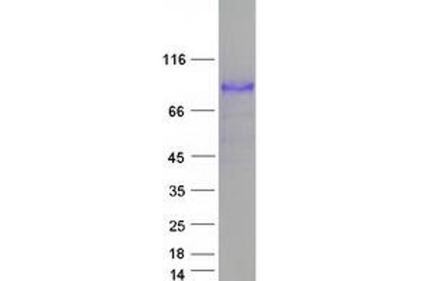 Integrin beta 2 Protein (ITGB2) (Transcript Variant 2) (Myc-DYKDDDDK Tag)