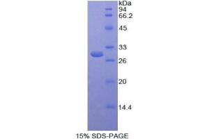 SDS-PAGE analysis of Human SELENBP1 Protein. (SELENBP1 Protein)