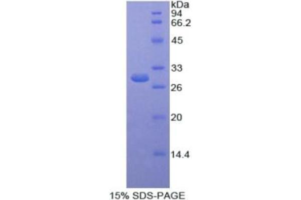 SELENBP1 Protein