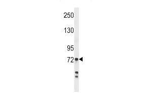 Western blot analysis in MDA-MB231 cell line lysates (35ug/lane). (Myeloperoxidase Antikörper  (AA 420-448))