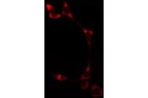 ABIN6275513 staining  HT29 cells by IF/ICC. (ATP2A1/SERCA1 Antikörper  (Internal Region))