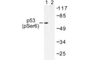 Image no. 2 for anti-Tumor Protein P53 (TP53) (pSer6) antibody (ABIN318095) (p53 Antikörper  (pSer6))