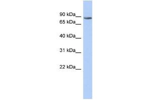 WB Suggested Anti-TMTC1 Antibody Titration:  0. (TMTC1 Antikörper  (Middle Region))