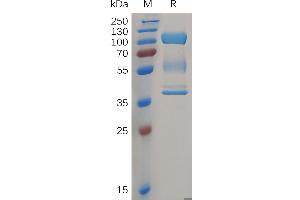 Human ZP3 Protein, hFc Tag on SDS-PAGE under reducing condition. (Zona Pellucida Glycoprotein 3 Protein (ZP3) (AA 23-386) (Fc Tag))