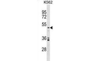 Western Blotting (WB) image for anti-Uronyl-2-Sulfotransferase (UST) antibody (ABIN2999336) (UST Antikörper)