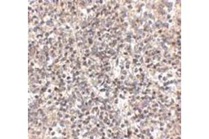 Immunohistochemistry (IHC) image for anti-R-Spondin 1 (RSPO1) (N-Term) antibody (ABIN1031546) (RSPO1 Antikörper  (N-Term))