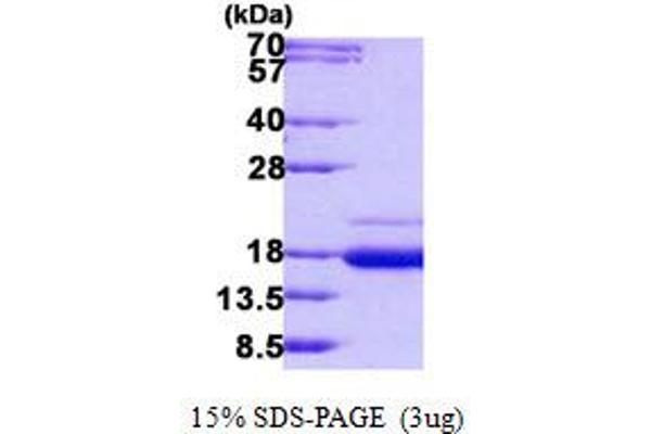 SSR2 Protein (His tag)