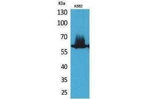 Western Blotting (WB) image for anti-Nuclear Factor-kB p65 (NFkBP65) (Thr743) antibody (ABIN3187851) (NF-kB p65 Antikörper  (Thr743))