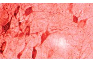 Immunohistochemistry analysis using Rabbit Anti-HO-1 Polyclonal Antibody . (HMOX1 Antikörper  (APC))