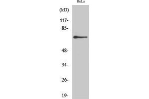 Western Blot analysis of HeLa cells using AR-β2 Polyclonal Antibody diluted at 1:2000. (Androgen Receptor beta 2 Antikörper  (AA 180-260))