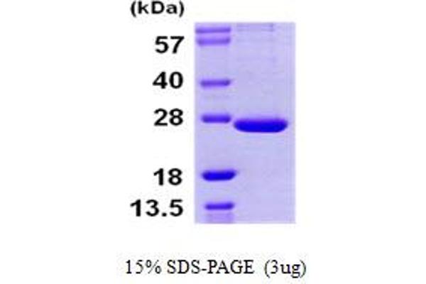 PSMB9 Protein (AA 21-219) (His tag)