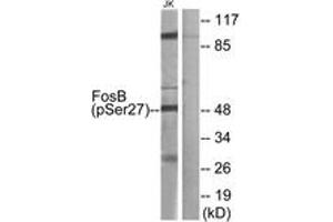 Western Blotting (WB) image for anti-FBJ Murine Osteosarcoma Viral Oncogene Homolog B (FOSB) (AA 12-61), (pSer27) antibody (ABIN482211) (FOSB Antikörper  (pSer27))